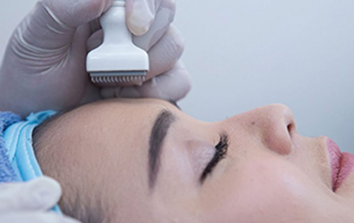 DERMA STAMP