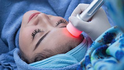 MICRODERMABRASI ATHENA