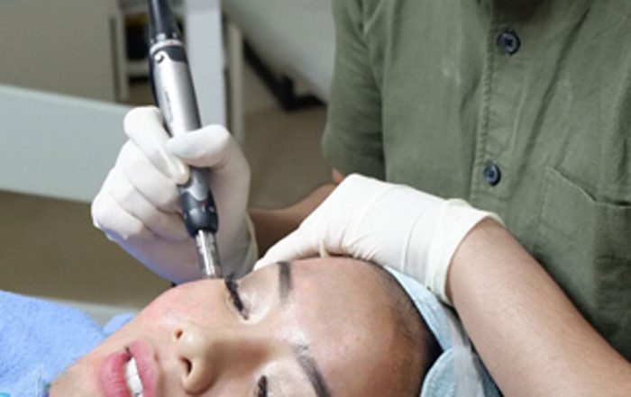 DERMAPEN