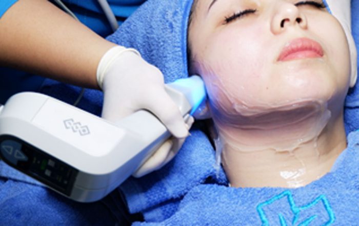 EXILIS