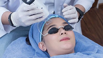 FRACTIONAL CO2 LASER