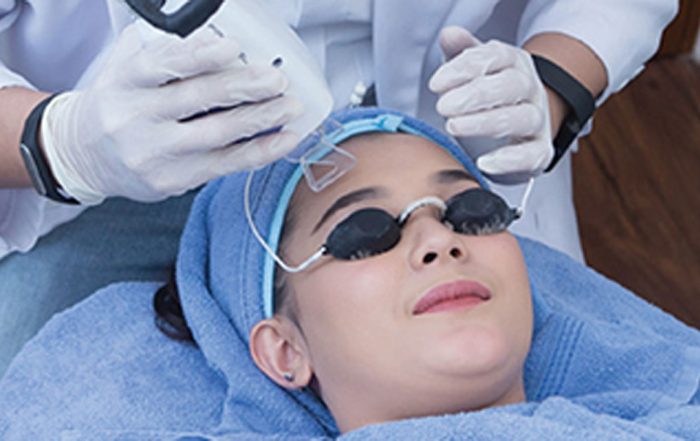 FRACTIONAL CO2 LASER
